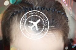 -大麦微针植发全国连锁