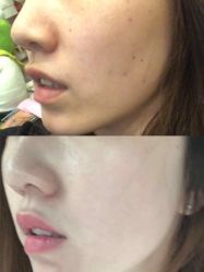 -Deeplus+韩国皮肤管理한국피부관리·C:Lab肌肤实验室