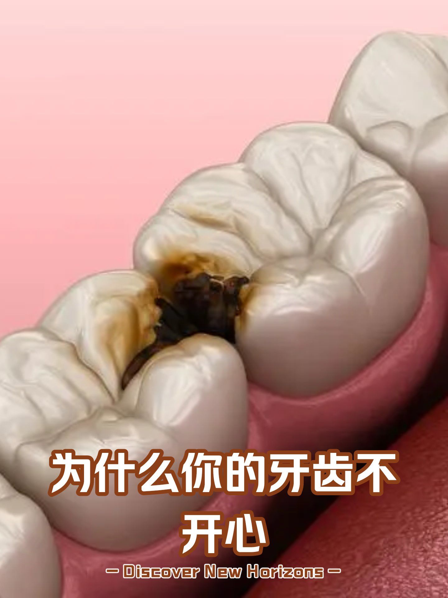 胶州中科维诺口腔科普 | "酸倒牙?遇冷遇热