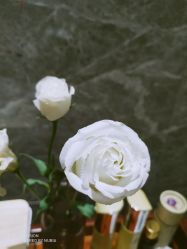 -苑苑vbeauty科技美容SPA