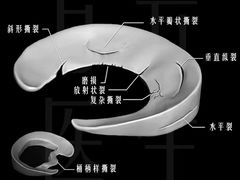 -APT运动康复中心(徐汇万科店)