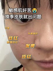 -香榭丽舍·海菲秀·皮肤管理痘敏肌修护
