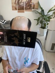 -发饰美男士增发补发假发定制店