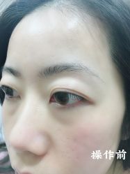 -西施无菌半永久纹绣眉眼影唇轻增发纹发际线