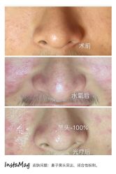 光SPA水氧+opt-光SPA科技美肤