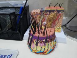 点击看大图 -雍禾植发全国连锁