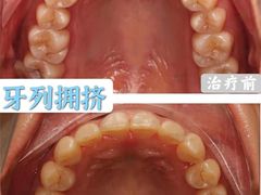 -团圆口腔·种植中心(锦江院区)