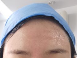 体验前-圣嘉新医疗美容医院