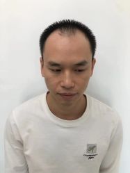 -发饰美男士增发补发假发定制店