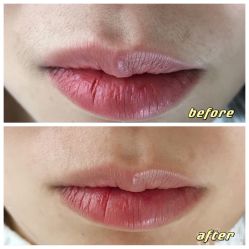 -植蔻妍倍儿专业脱毛·皮肤管理