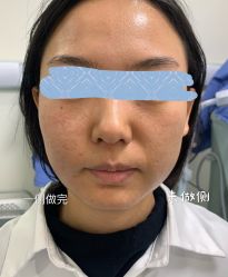 -八大处整形
