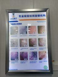 -北京豆豆博士专业祛痘