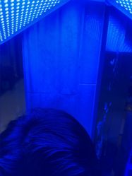 -碧莲盛·不剃发植发