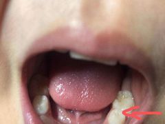 -华颜美口腔矫正·种植牙