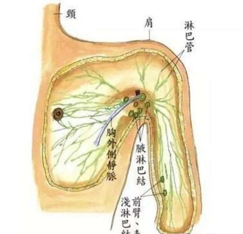 腋窝淋巴结示意图图片