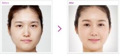 点击看大图 -SKINIST丽铂医疗美容