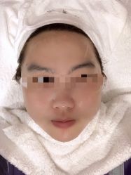 -初樱科技美学问题肌修复中心