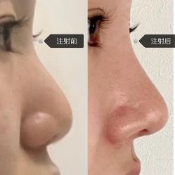 -上海伊莱美医疗美容医院