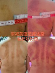 -丽减美瘦吧·减肥瘦身