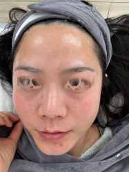 体验前-原力医疗美容