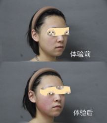 -圣嘉新医疗美容医院