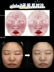 -Yestar重庆艺星医疗美容医院