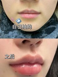 -上海伊莱美医疗美容医院