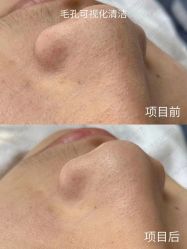 -凡碧诗毛孔收细