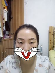 点击看大图 -Doris多里斯半永久纹眉·SMP纹发·发际线