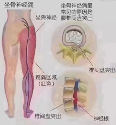 -香薇妮丝女子减肥院