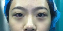 -天津健丽·去眼袋医疗美容机构