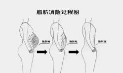 -香薇妮丝·定制减肥·身材管理