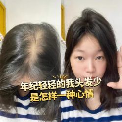 -唐风采假发补发定制