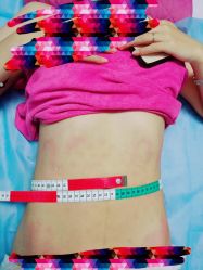 -清媚减肥瘦身纤体