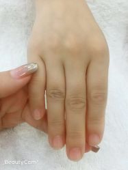 点击看大图 -郡艺医疗美容·微整·眼鼻吸脂