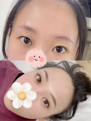 -Doris多里斯半永久纹眉·SMP纹发·发际线
