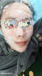 体验前-More摩尔医美の注射线雕光电中心