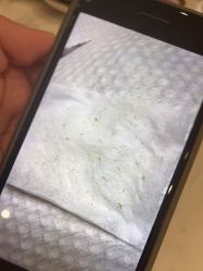 -苑苑vbeauty科技美容SPA