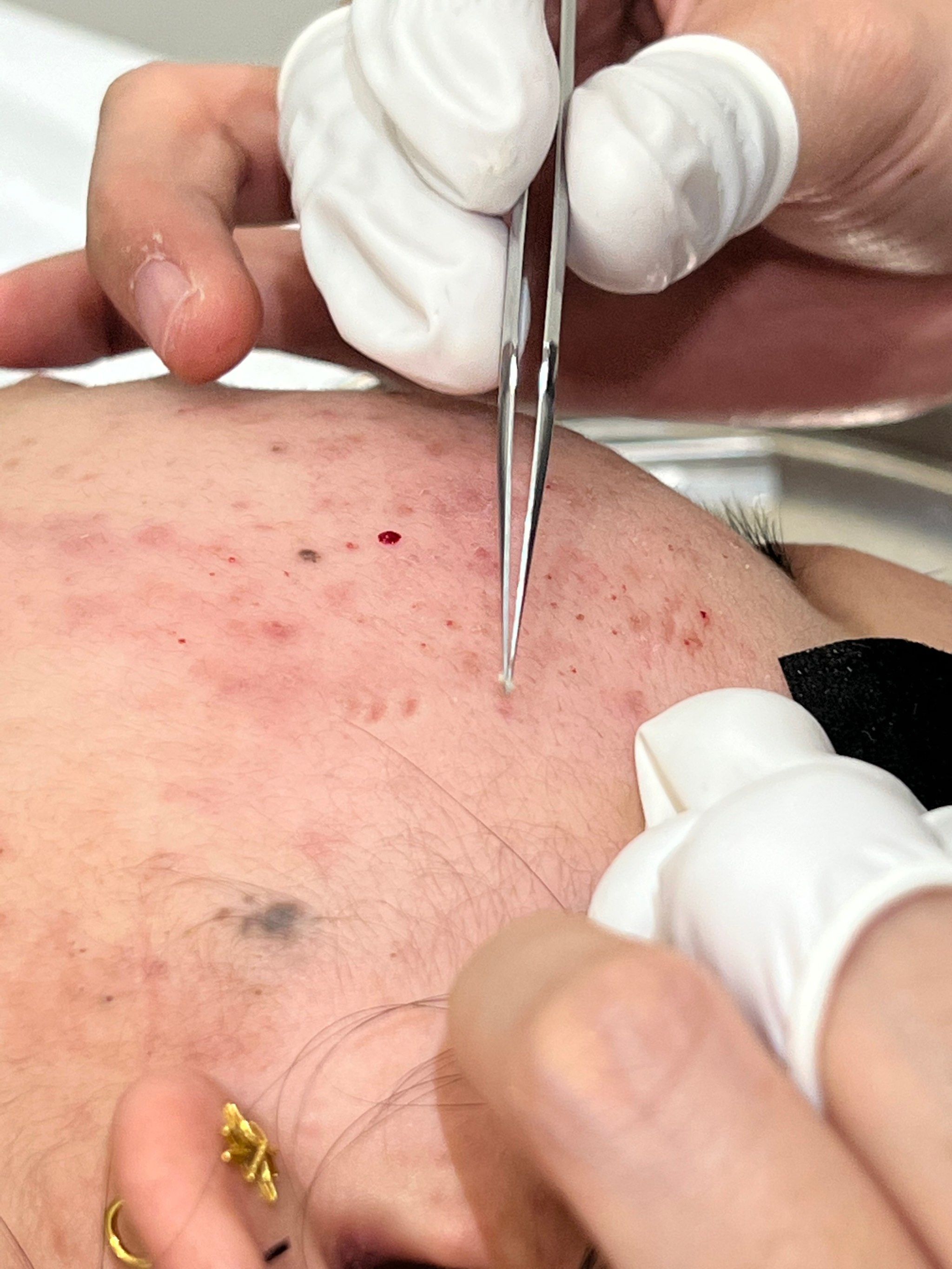 挤了这么多,太爽了