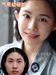 -Yestar重庆艺星医疗美容医院