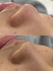 -SKIN79皮肤管理中心