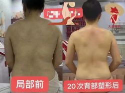 点击看大图 -大唐辣妈东方塑身