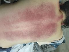 -张钰强中医正骨推拿连锁(唐家人才公寓店)