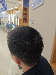 -大麦微针植发全国连锁