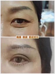 -上海漾颜医疗美容