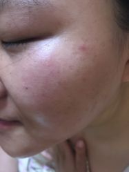 -金品苗方专业祛痘中心