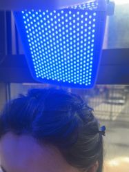 -碧莲盛·不剃发植发