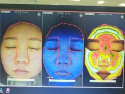皮肤诊断-光SPA科技美肤