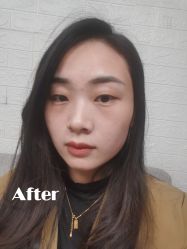 -广州美莱医疗美容医院