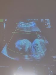 -郑州万安妇产医院